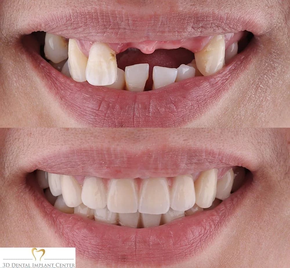 3D Dental Implant Center gallery photo 5