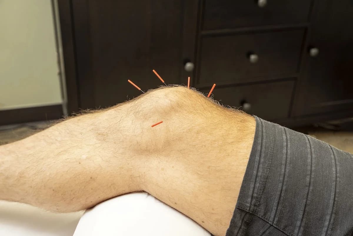 CORE ACUPUNCTURE health+wellness gallery photo 3