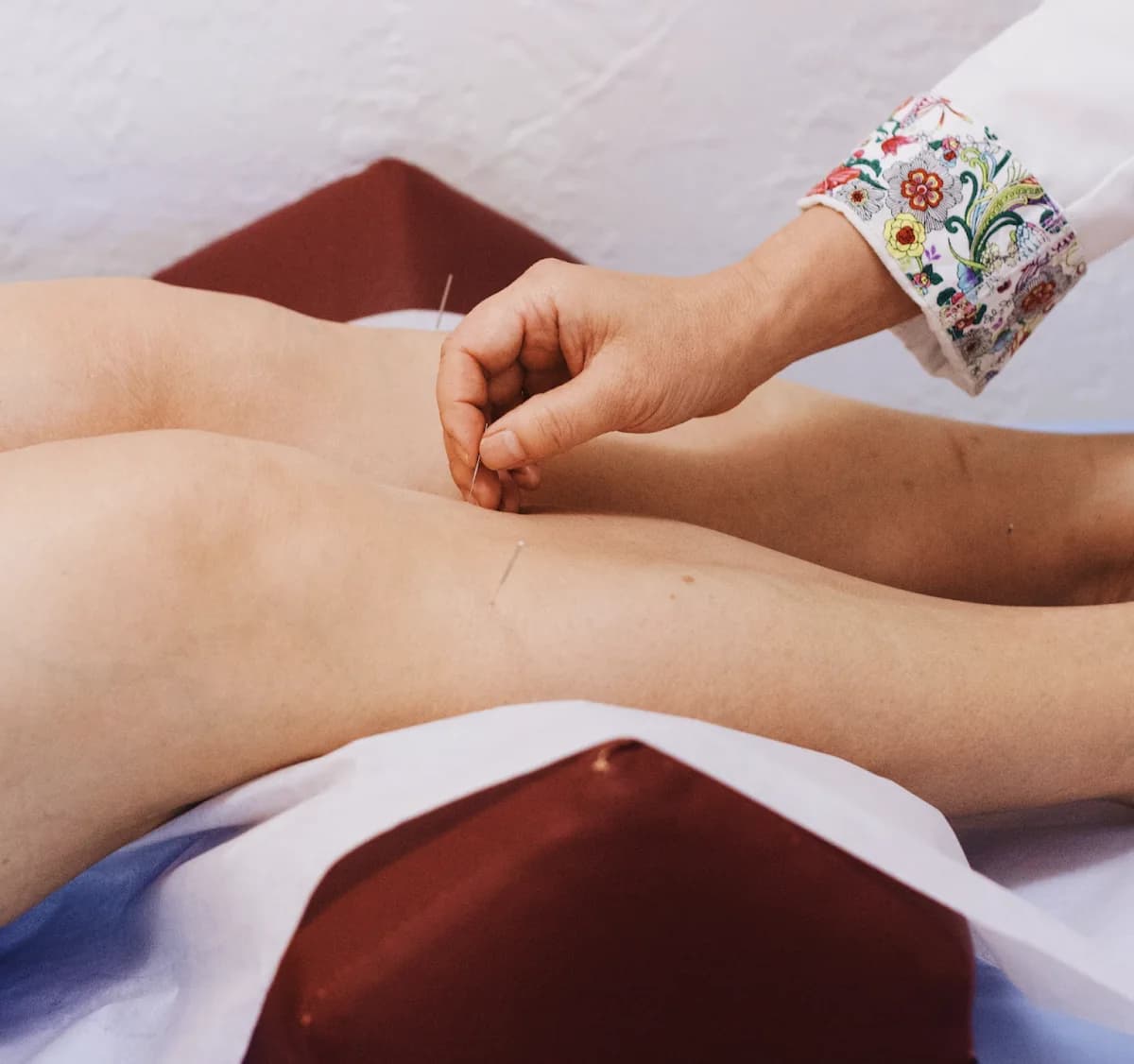 Tian Chao Herbs & Acupuncture gallery photo 3