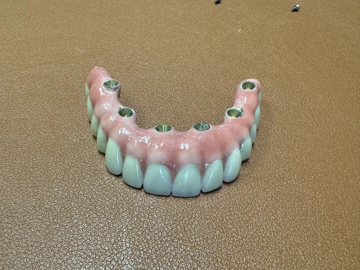 We Smile Dental Cheng Wang DMD 微笑牙科 王成牙医博士 gallery photo 2