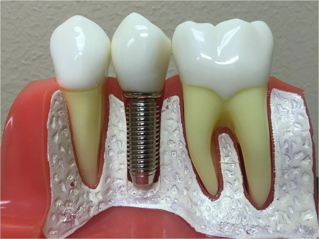 We Smile Dental Cheng Wang DMD 微笑牙科 王成牙医博士 gallery photo 3